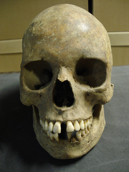 A skull from the East Smithfield plague pits