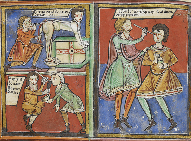 Doctor's orders: illustrations of operations for haemorrhoids, nasal polyps and the eye, England or France, c.1190. © British Library Board/Bridgeman Images.