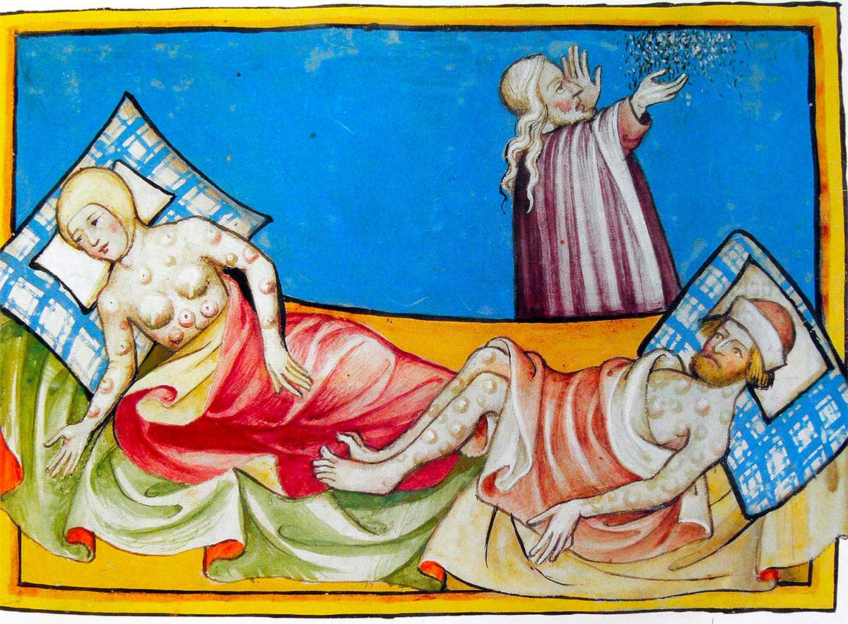 Miniature out of the Toggenburg Bible (Switzerland) of 1411. The disease is widely believed to be the plague, although the location of bumps and blisters is more consistent with smallpox.