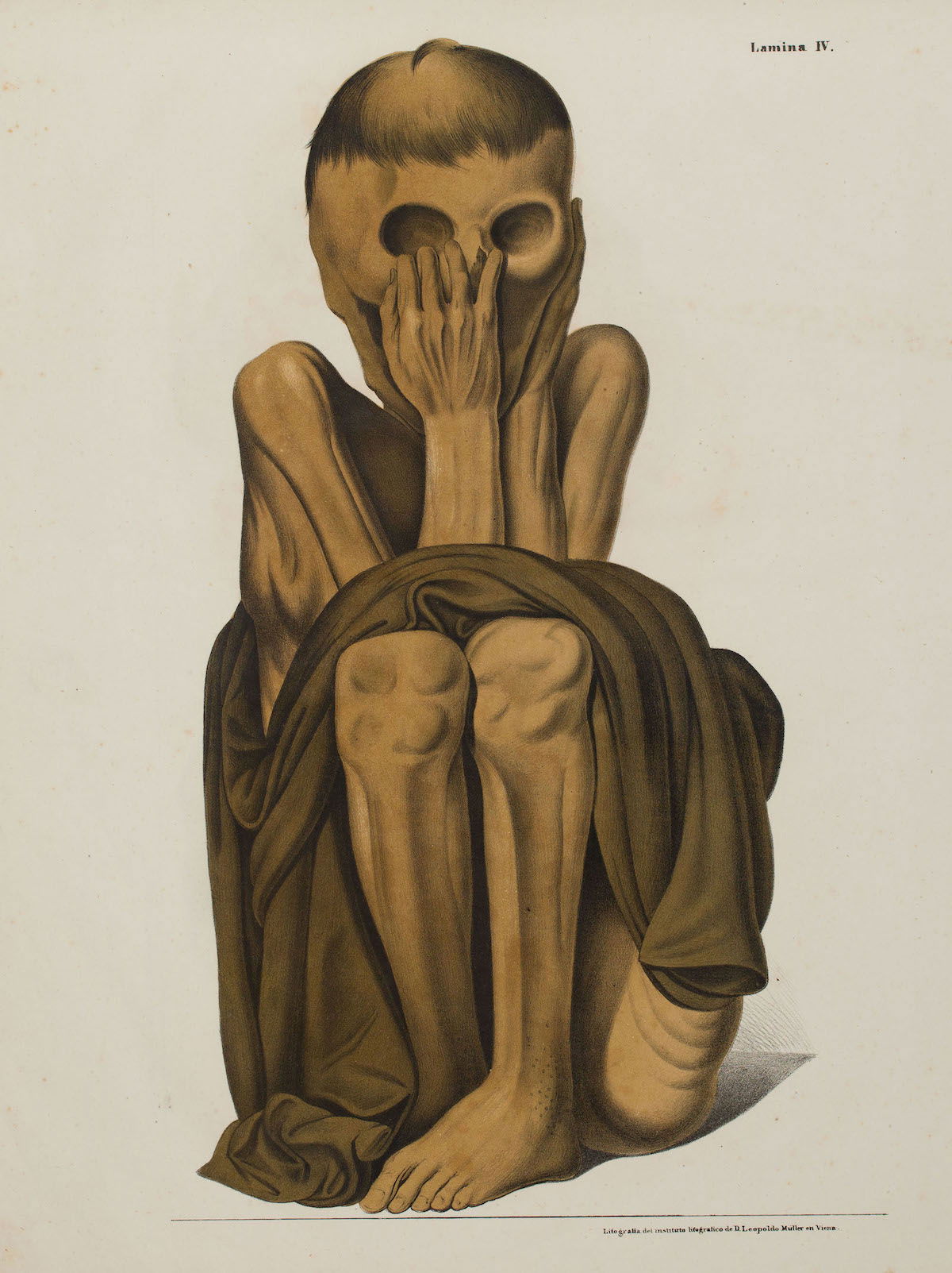 An illustration from Antiguedades Peruanas, by Mariano Eduardo de Rivero and Juan Diego de Tschudi (1851), showing an Inca mummy. Christopher Heaney.