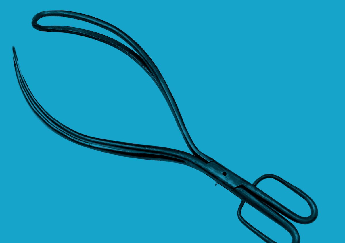 Obstetrical forceps, designed by the Chamberlen family in the 1600s. Wellcome Collection. Public Domain. Obstetrical forceps, designed by the Chamberlen family in the 1600s. Wellcome Collection. Public Domain.