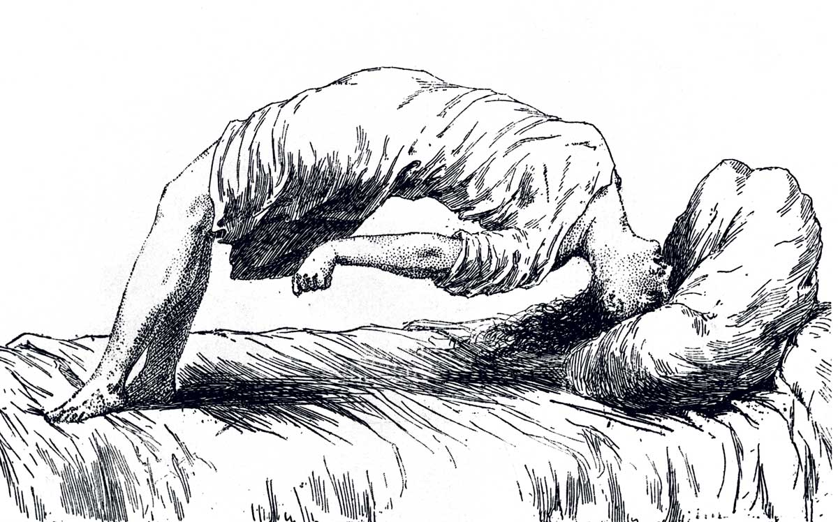 An illustration of a hysterical patient, from Les Maladies épidémiques de l’esprit, by Paul-Marie Léon Regnard, 1884 © Bridgeman Images.