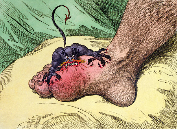 'The Gout' by James Gillray, hand-coloured etching, 1799. Bridgeman/courtesy of the Warden & Scholars of New College, Oxford