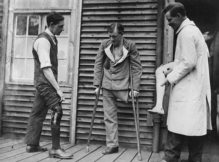 a british soldier is fitted for an artificial leg by the american red cross at roehampton hospital, london, 1918. Library of Congress. Public Domain.