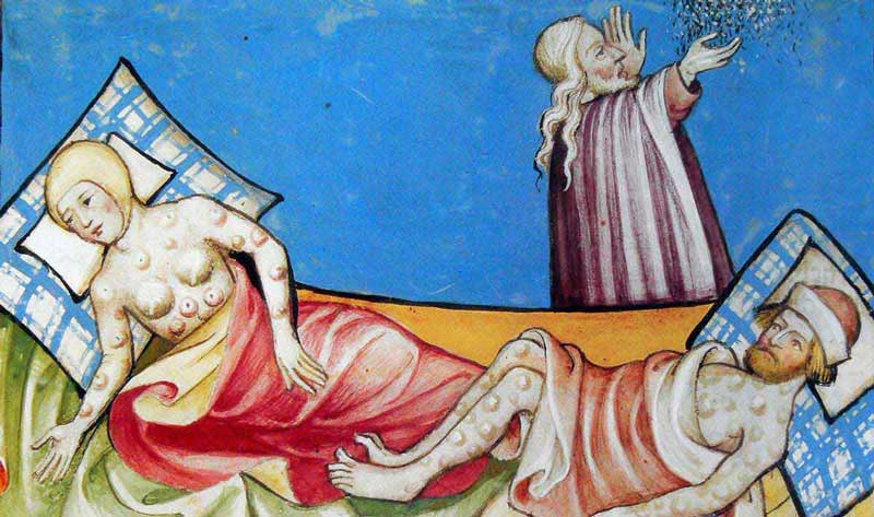 Miniature from the Toggenburg Bible (Switzerland), 1411. The disease is widely believed to be the plague, although the location of bumps and blisters is more consistent with smallpox.