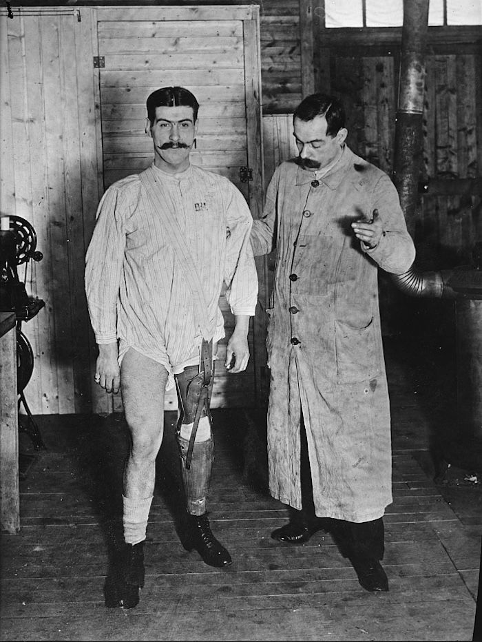 A French soldier learns to walk on an artificial leg at Roehampton Hospital, London, 1918. Library of Congress. Public Domain.